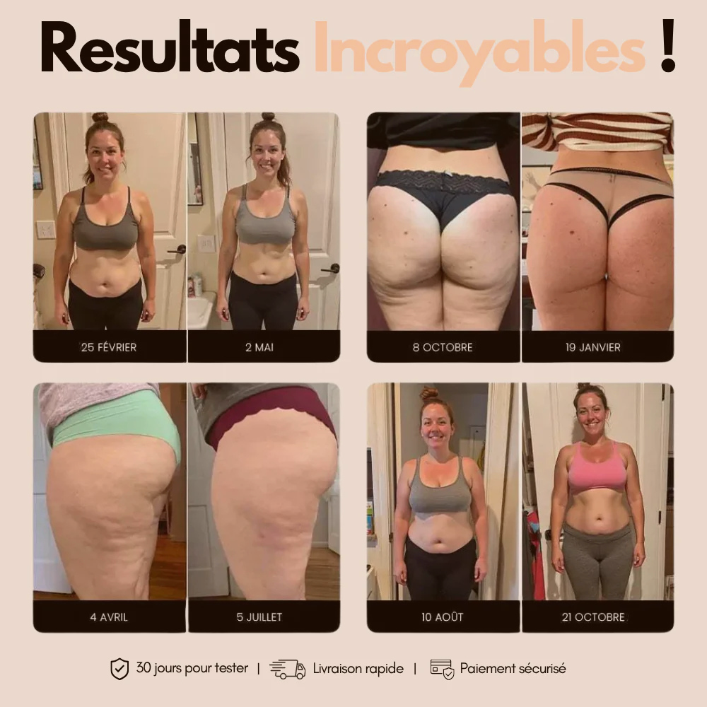 Cellulisse® Leggings 3D