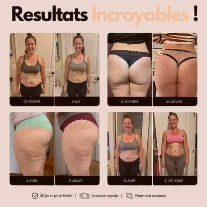 Cellulisse® Leggings 3D